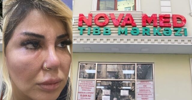 media-nova