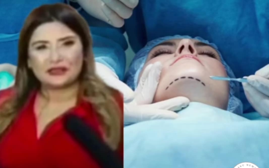 Dəniz Hospitalında qanusuz estetik əməliyyat edən “Dr Emma” kimdir? -